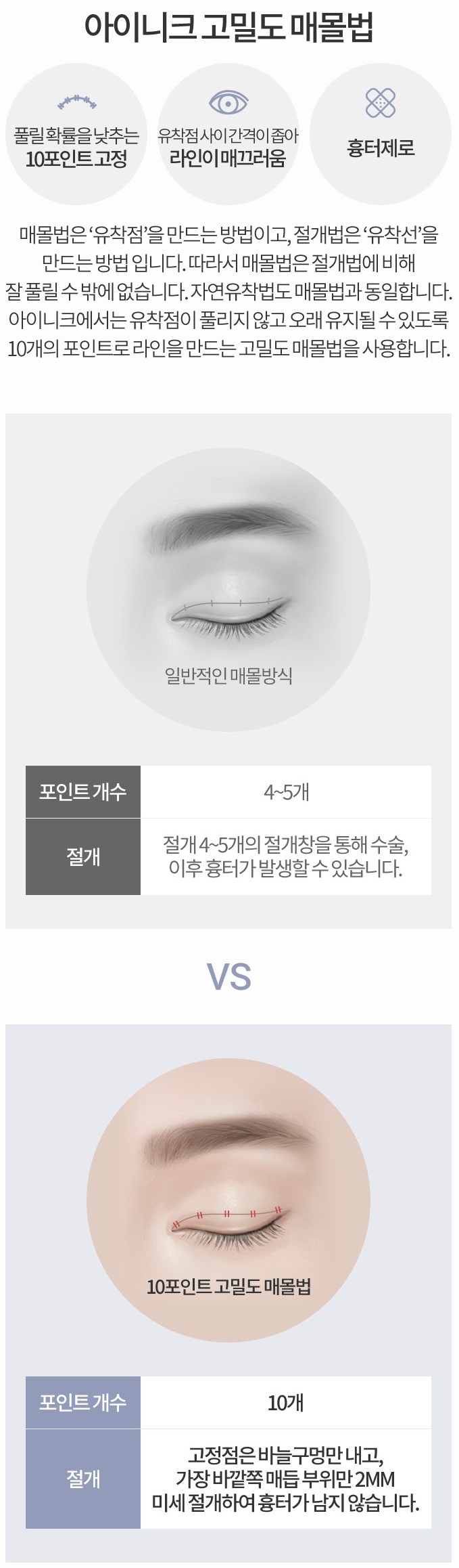 쌍꺼풀수술자국 걱정 없이 예쁘게! 관련 이미지 5