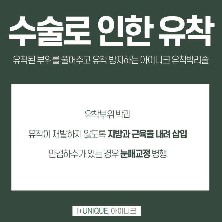 압구정눈재수술병원 방황하지 말고 아이니크성형외과에서 관련 이미지 5