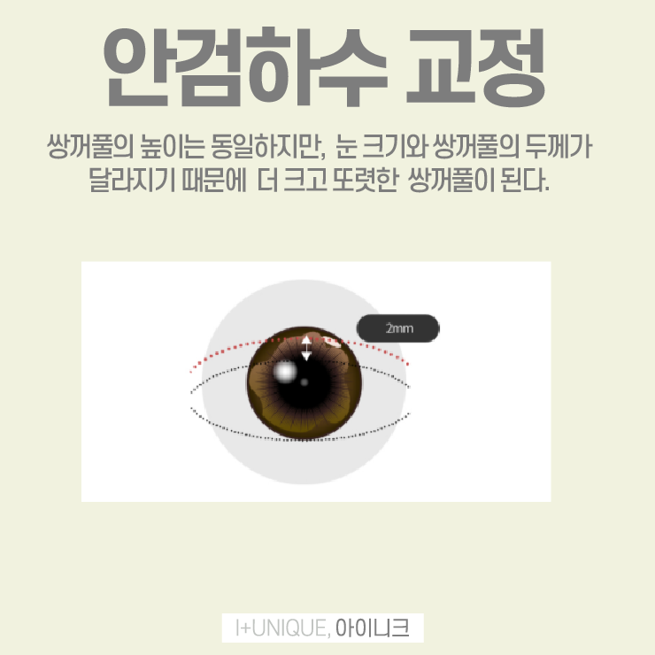 눈재수술추천을 알아보고 있다면 바로 여기 아이니크성형외과 관련 이미지 4