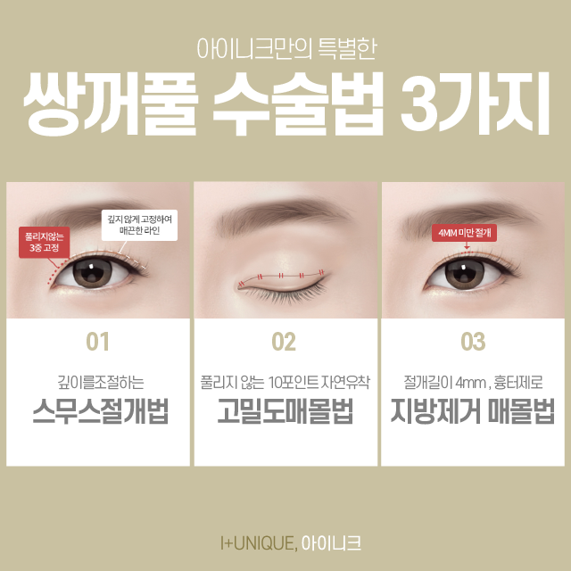 Types of Double Eyelid Surgery: Which Design Suits My Eyes? image 2