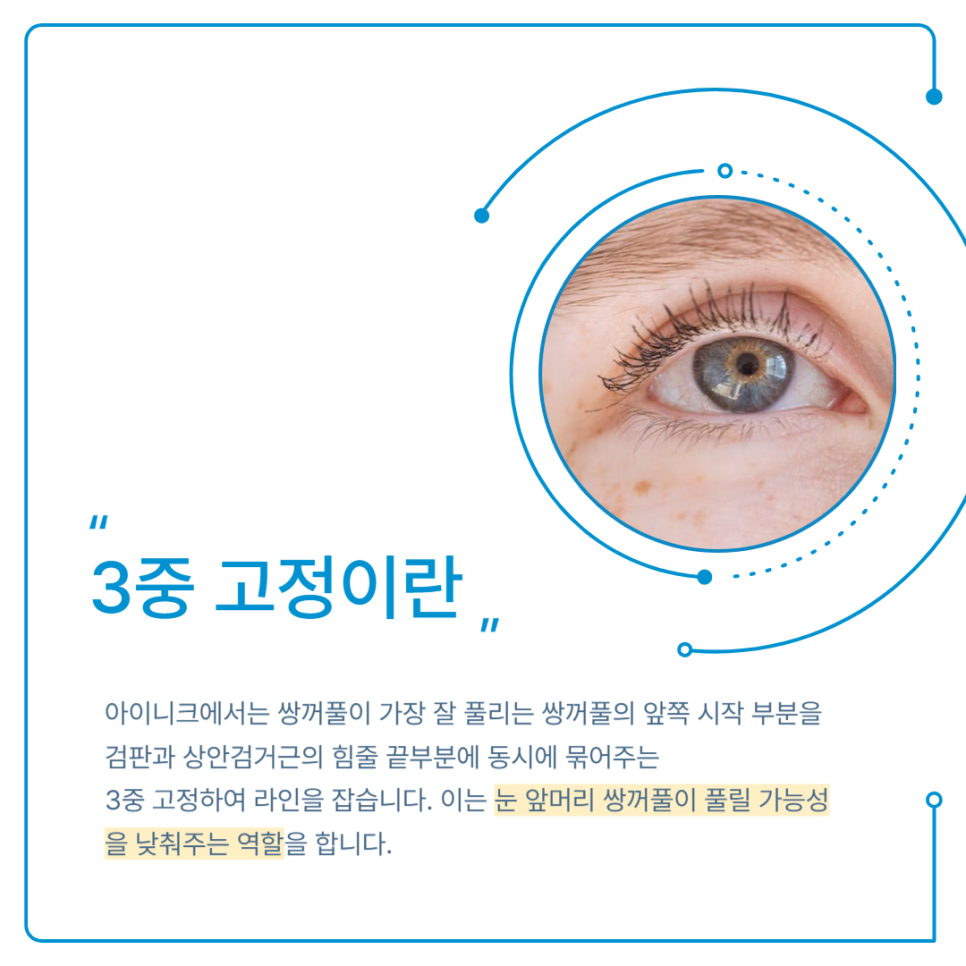 눈크게하는수술 절개법이란? 관련 이미지 5