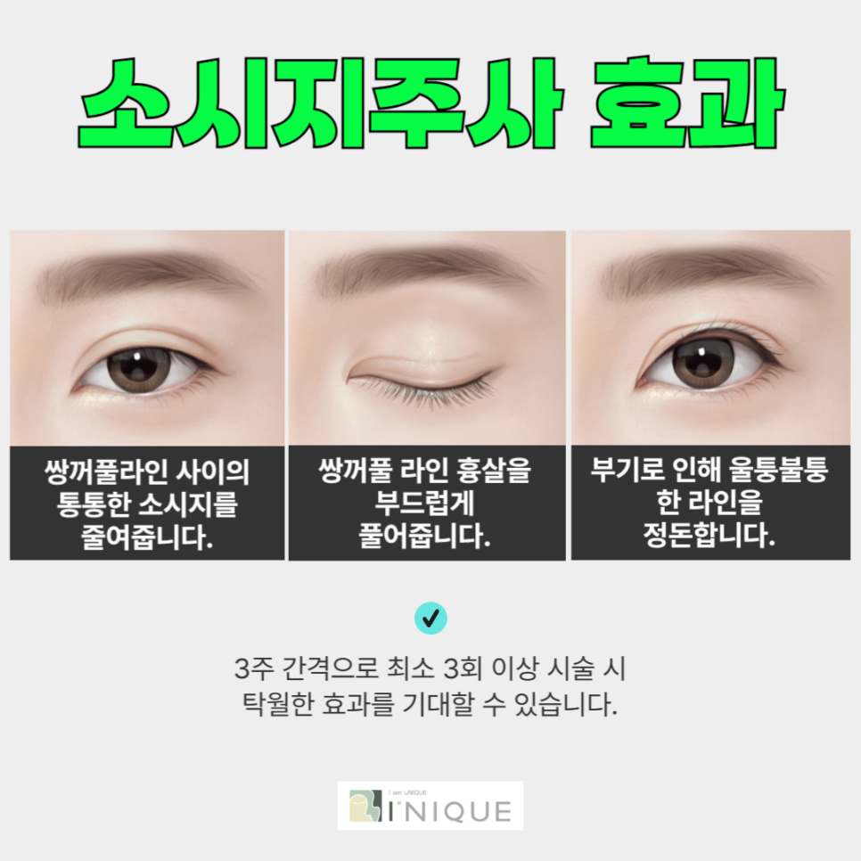 Double Eyelid Scar Tissue Removal, Easily Resolved with an Injection image 4