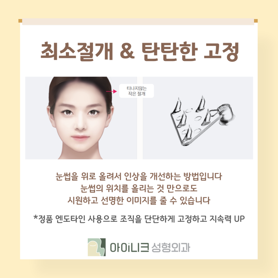 눈썹을 올려 인상을 개선? 브로우업 관련 이미지 10