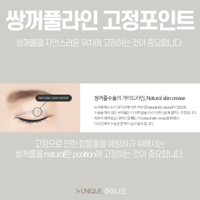 속눈썹들림으로 속상한 내 눈, 어떻게 되돌릴 수 있을까? 관련 이미지 3