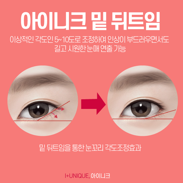 강남눈성형외과에서 트임수술을 원한다면 아이니크에서 알아보자 관련 이미지 5