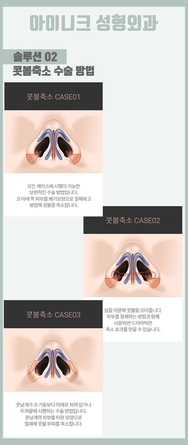 콧망울축소수술 이상적인 비율로 복코 개선! 관련 이미지 5