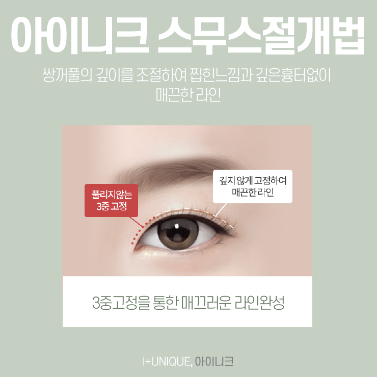 쌍꺼풀수술절개와 비절개 어떤 것이 좋을까 아이니크성형외과에서 알아보자 관련 이미지 3