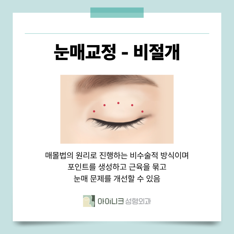 서울안검하수 눈꺼풀에 덮혀서 답답한 눈이라면? 관련 이미지 7