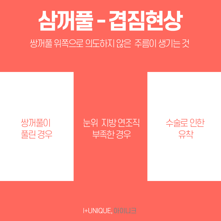 성형외과재수술은 보다 신중하게 결정하자 아이니크성형외과에서 관련 이미지 4