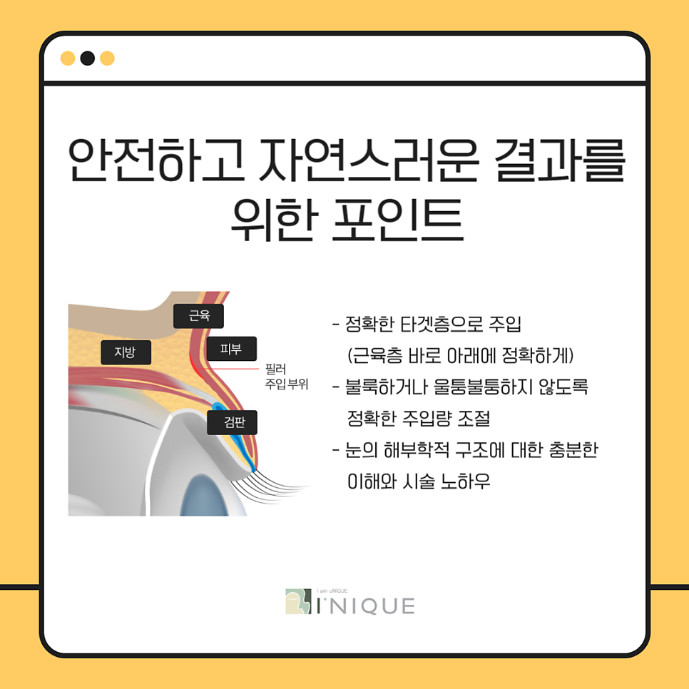 필러잘하는병원 안전함까지 갖췄어요 관련 이미지 4