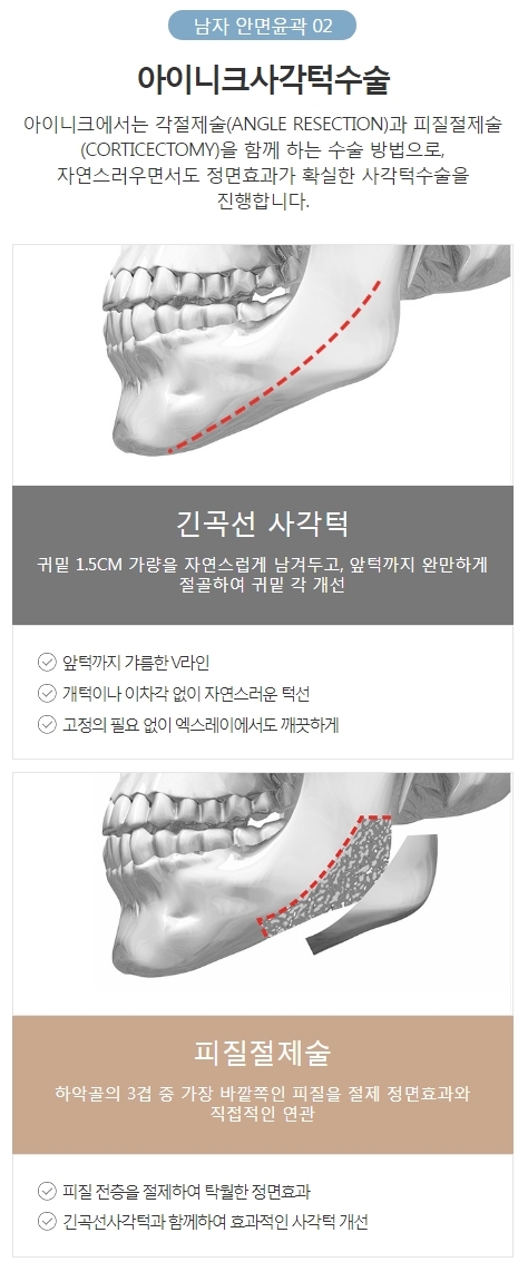 남자양악수술가격 비율에 맞는 자연스러운 라인! 관련 이미지 4