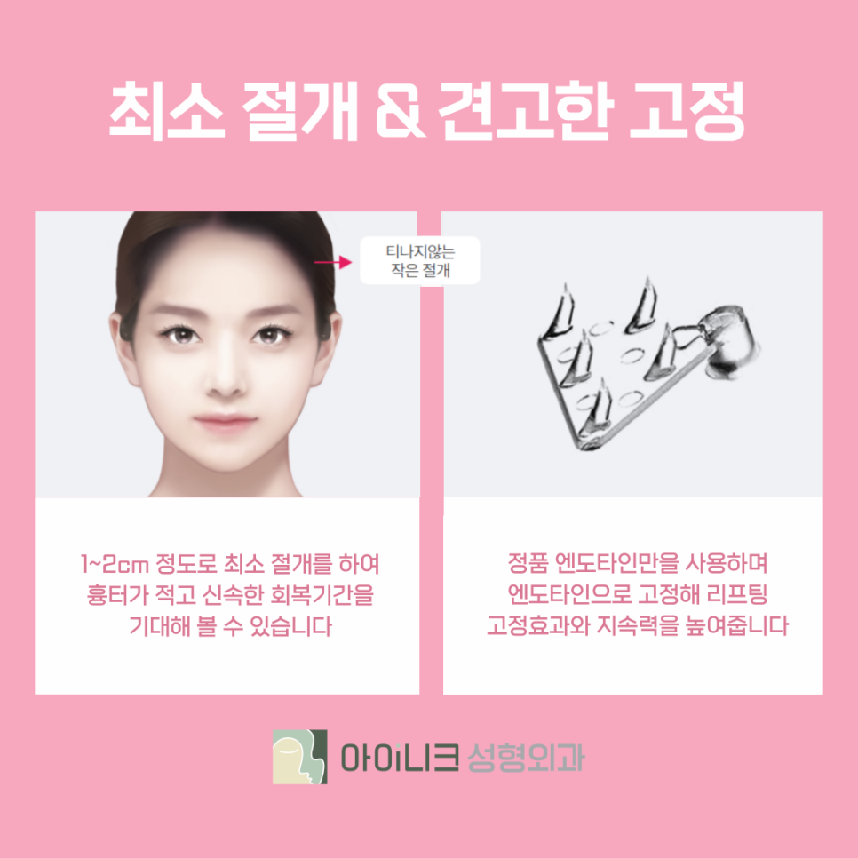 Creating Clear, Defined Eyes with the Gangnam Brow Lift Effect image 6