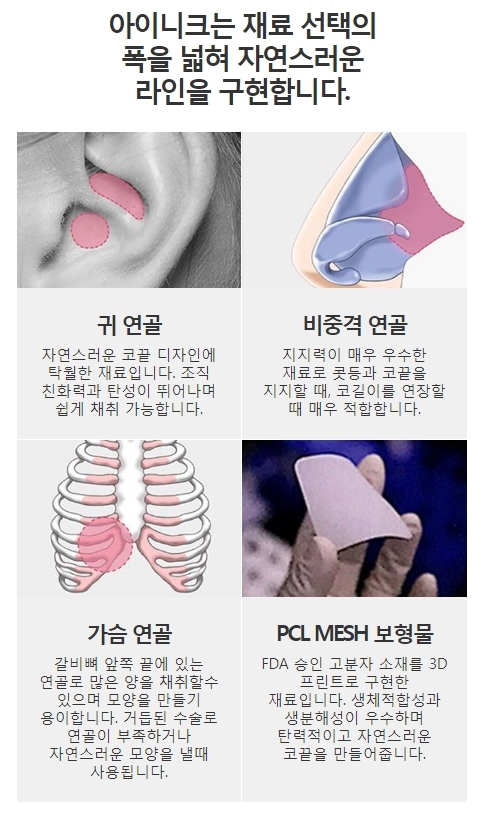 늑연골코재수술 안전한 보형물로 자연스럽게! 관련 이미지 6
