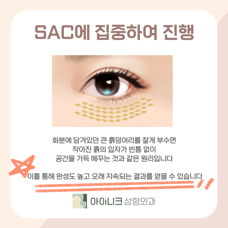 눈밑지방제거가격만큼 중요한 진행방식 관련 이미지 9