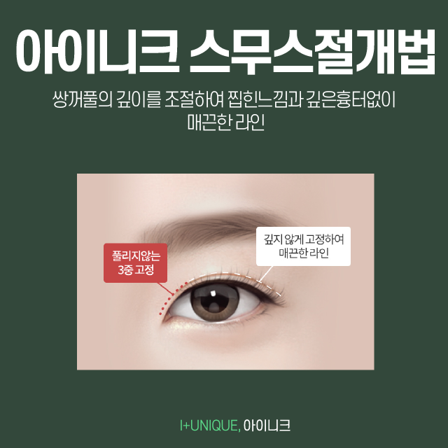 쌍꺼풀수술잘하는곳 아이니크에서 알려주는 자연스러운 쌍수요소 관련 이미지 3