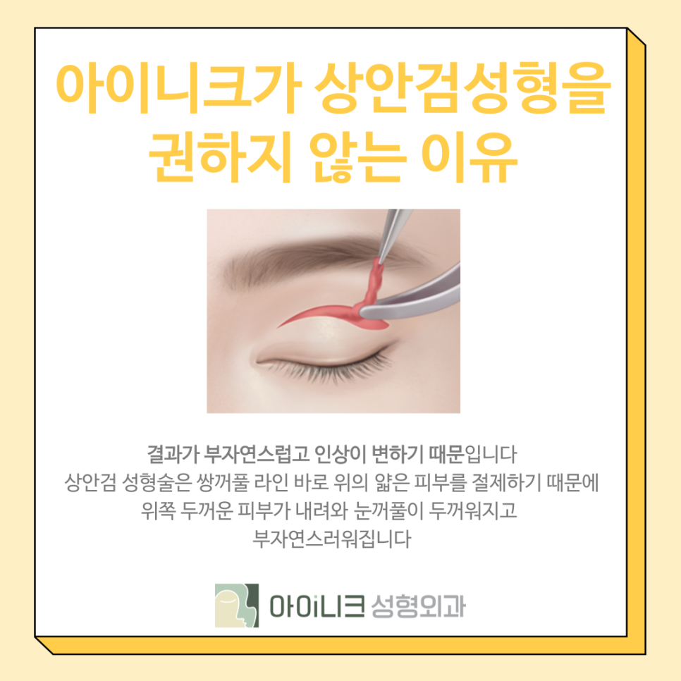 A Plan for Lower-Eyelid Surgery in Your 50s for Middle-Aged Men image 6
