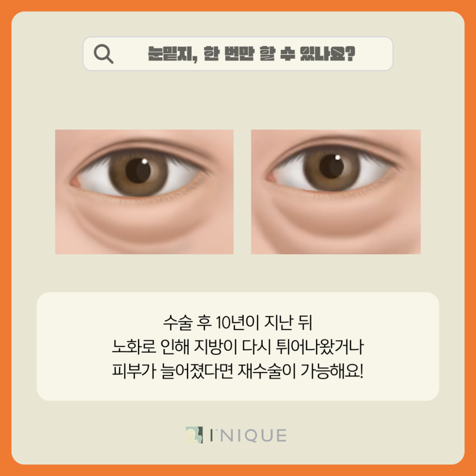압구정 앙코르눈밑지 적정 연령은? 관련 이미지 4