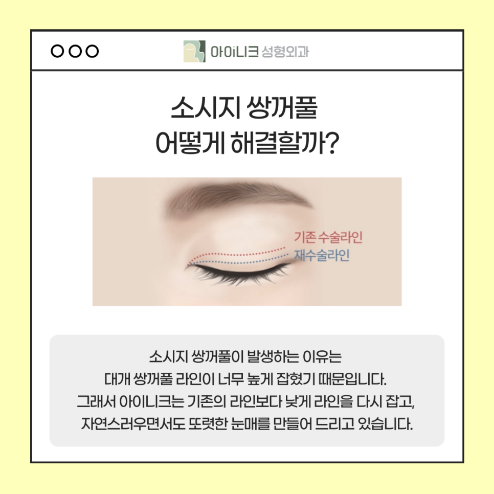 When You’re Looking for an Apgujeong Eye Plastic Surgery Clinic image 5