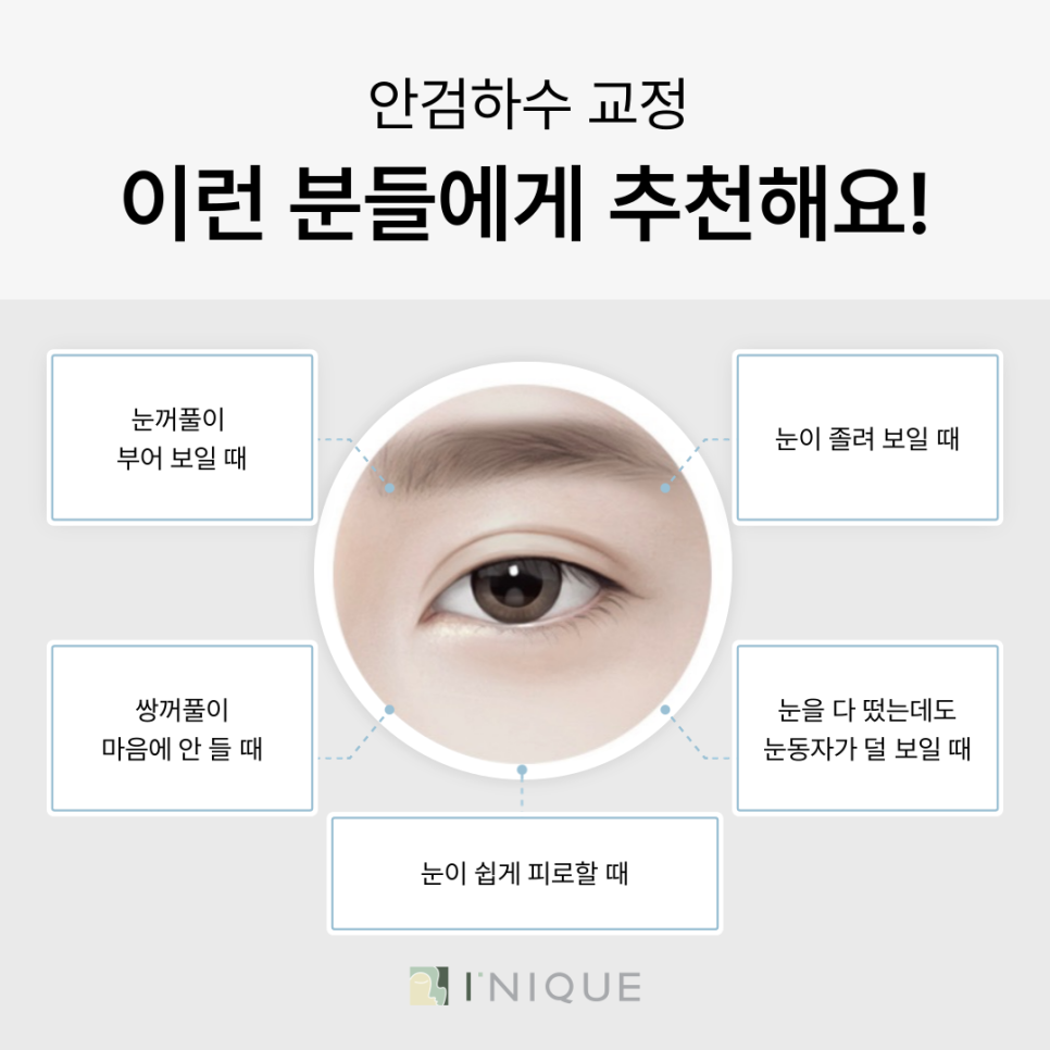 소세지쌍꺼풀재수술, 고민되시나요? 관련 이미지 4