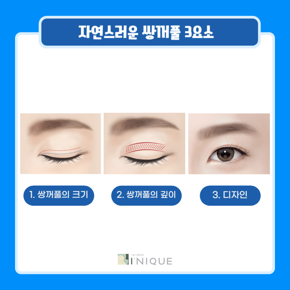 남자쌍꺼풀수술비용 보다 중요한 것은? 관련 이미지 2