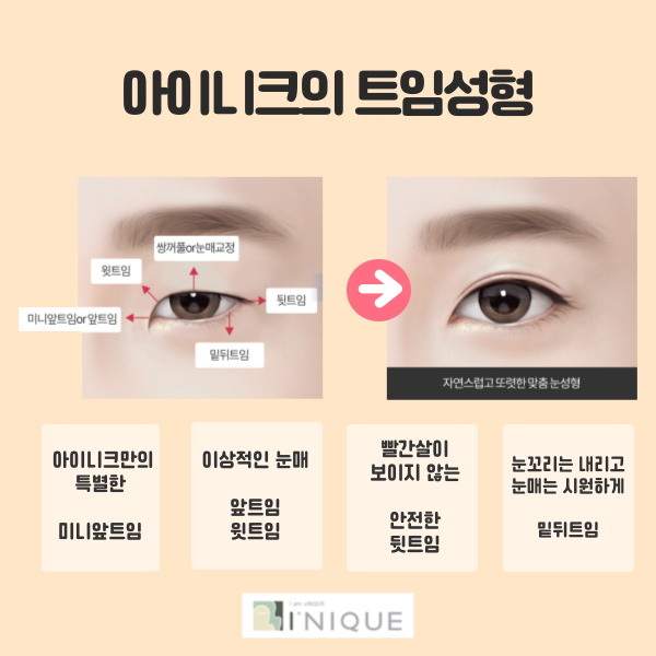 Eyelid Corner Surgery: Natural Results Are Essential! image 2
