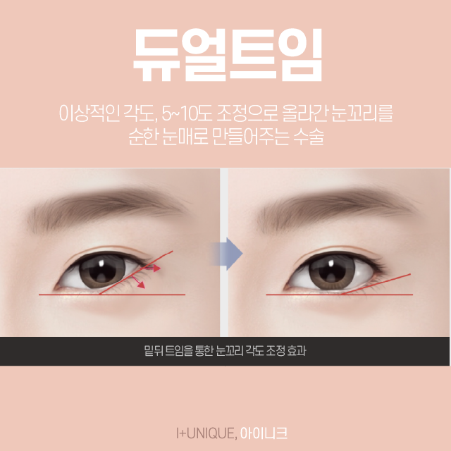 듀얼트임, 듀얼트임가격 한 번에 상담받기! 관련 이미지 5