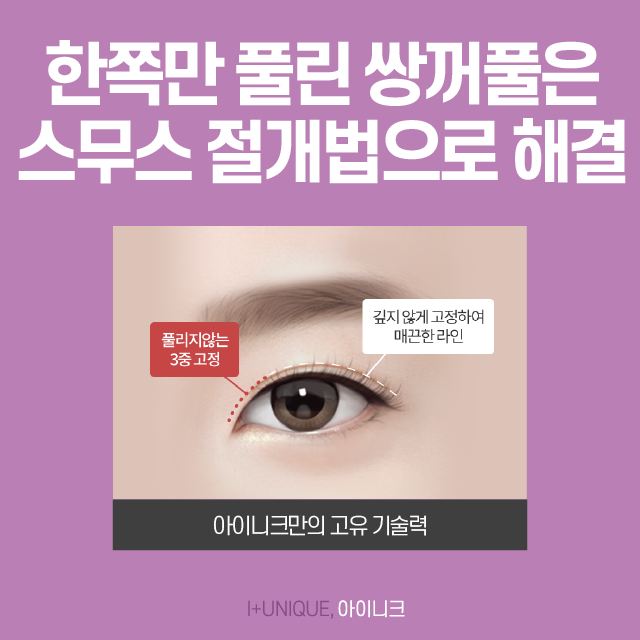 풀려버린 외꺼풀, 겹쌍꺼풀로 스트레스 받지 마세요! 관련 이미지 2