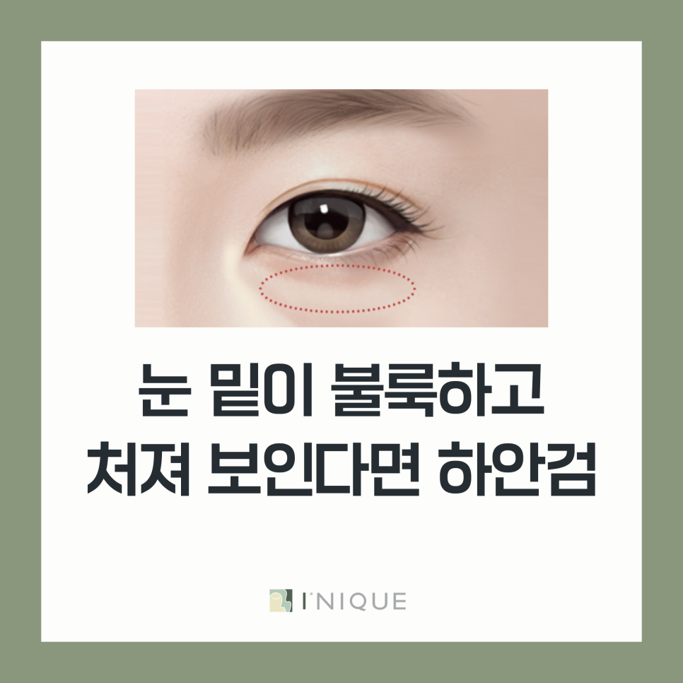 중년 눈성형 잘하는 병원, 하안검과 눈썹밑리프팅 함께봐야하는 이유 관련 이미지 3
