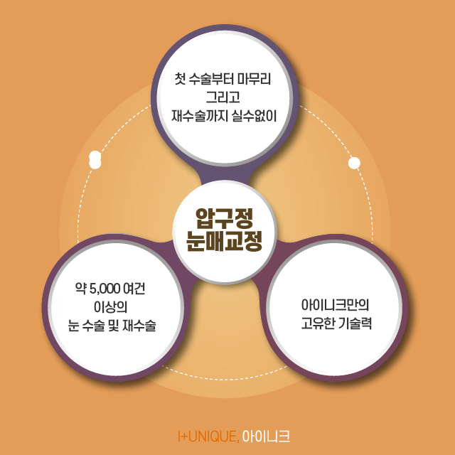 압구정눈매교정, 원인부터 결과까지 확실하게 알아야 합니다. 관련 이미지 6