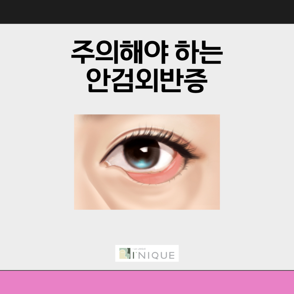 Are You Worried About Sagging Eyelids in Middle Age? image 5