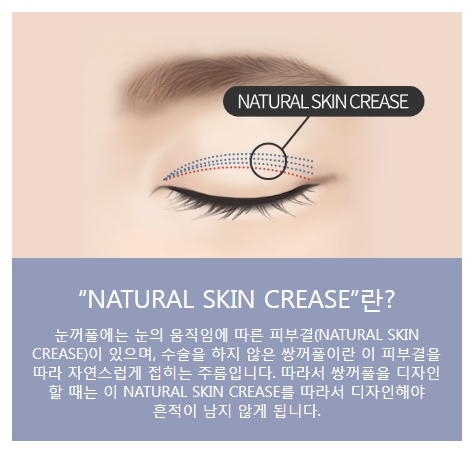 연예인쌍커풀 같은 자연스럽고 또렷한 눈매를 원한다면! 관련 이미지 3