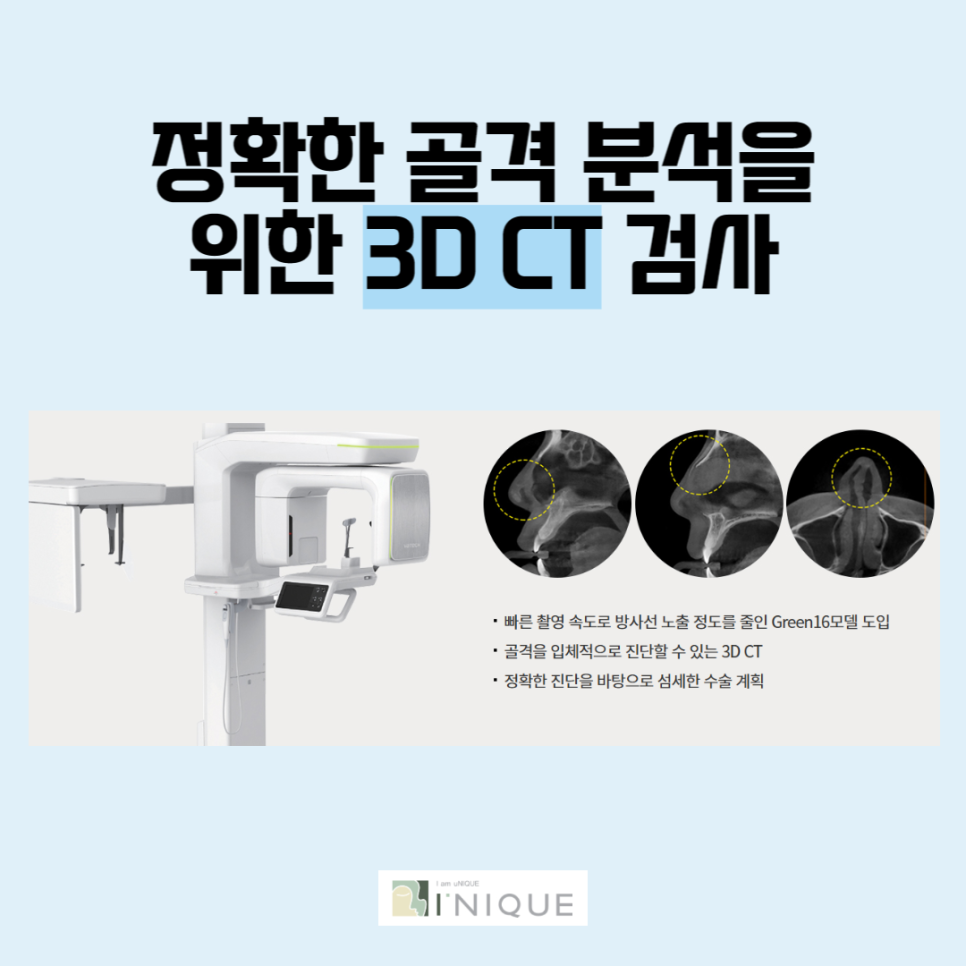 남자코성형후기가 많은 아이니크 관련 이미지 3