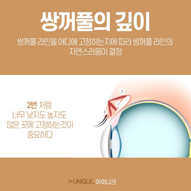 티안나는쌍꺼풀을 만들기 위해서는 신경써 주어야 할 것이 있습니다. 관련 이미지 4