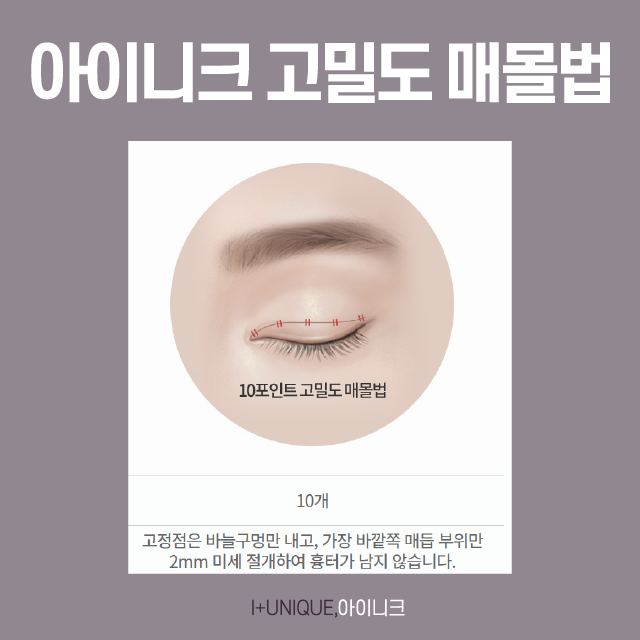 여자눈성형종류 나에게 맞는 방법은? 관련 이미지 3