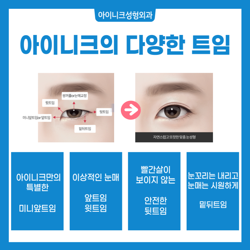 뒤트임 밑트임에 대해 알아보자! 관련 이미지 2