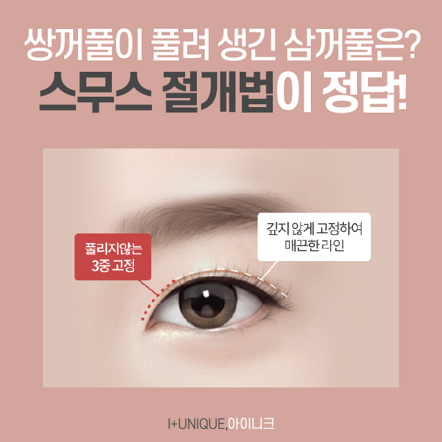 If Suddenly Having Multiple Double Eyelid Folds Feels Confusing? image 3