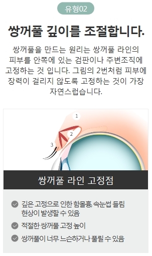 속눈썹들림 쌍수 후 흉터 개선 방법은? 관련 이미지 4