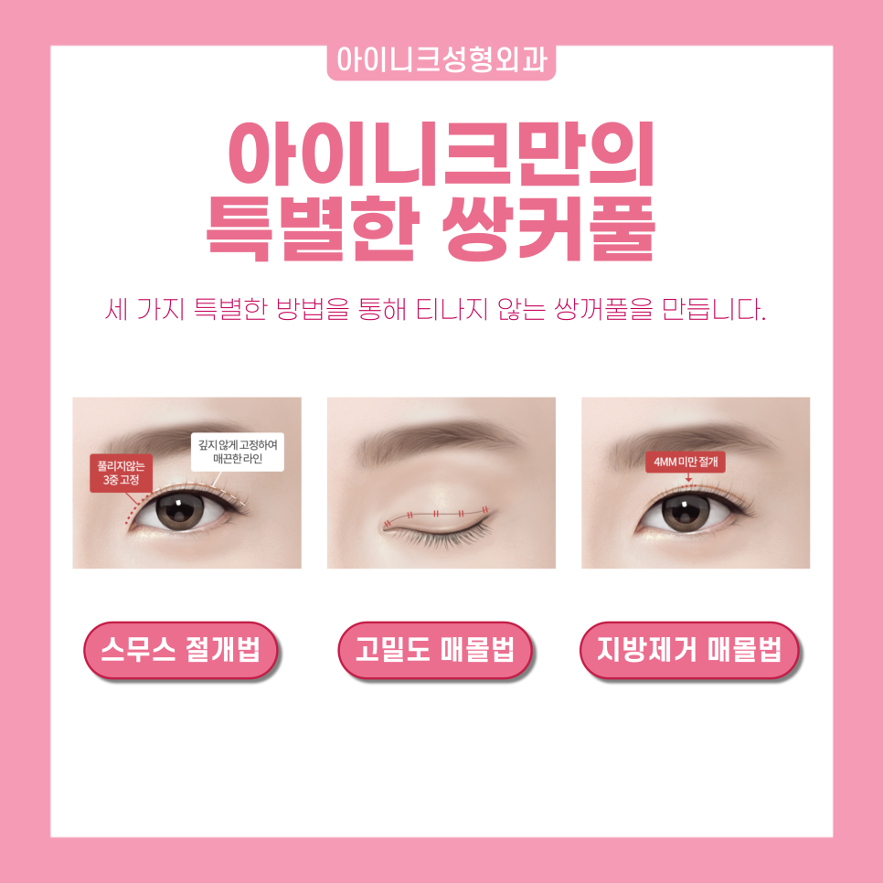 연예인눈성형을 원한다면 눈 성형 전문의에게! 관련 이미지 2