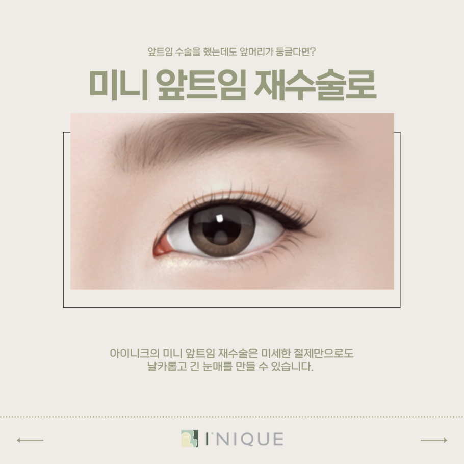 눈재수술잘하는병원, 어떻게 찾을까요? 관련 이미지 4