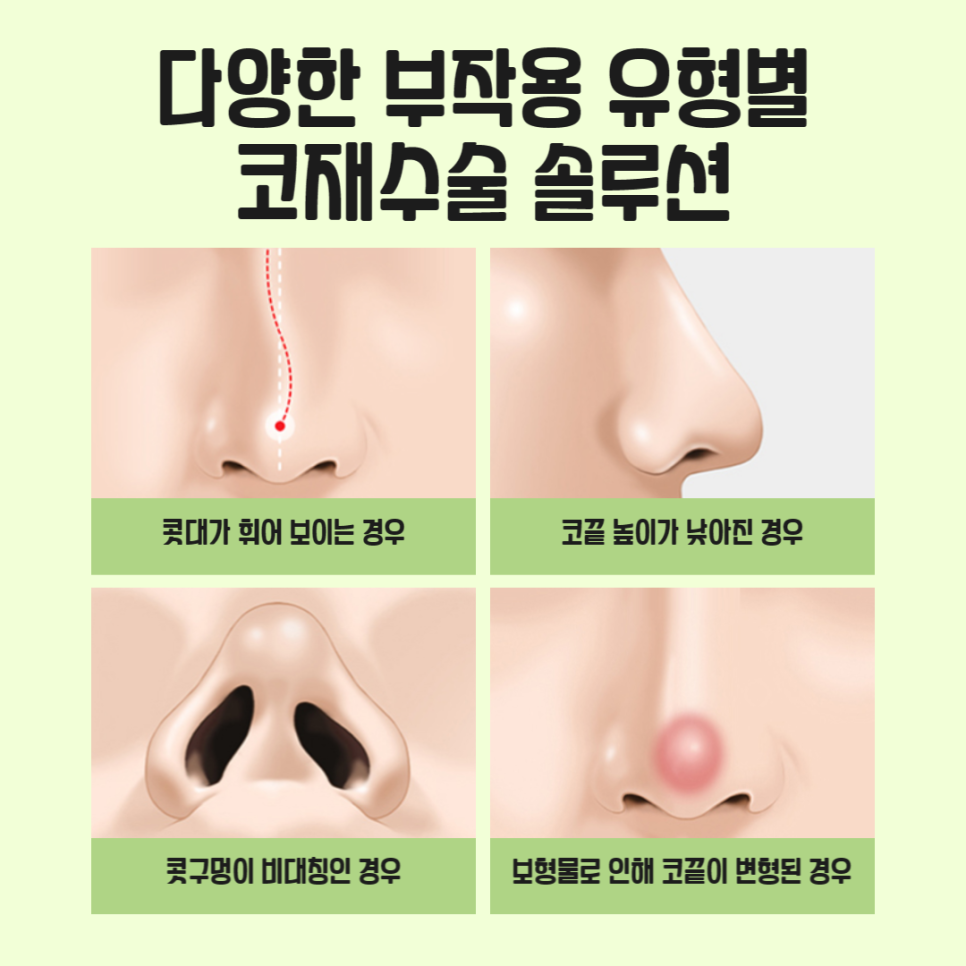If You’re Worried About Complications After Revision Rhinoplasty image 4