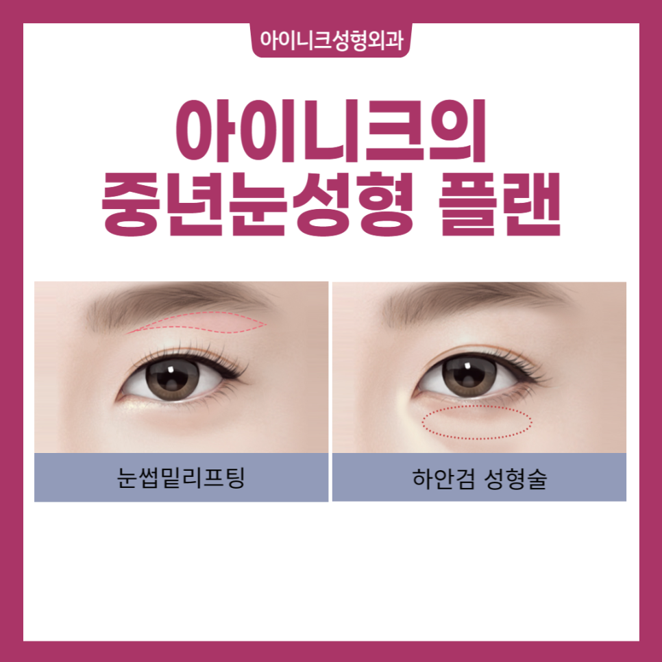 Lower Blepharoplasty for the Under-Eye Area, Safe and Successful image 2