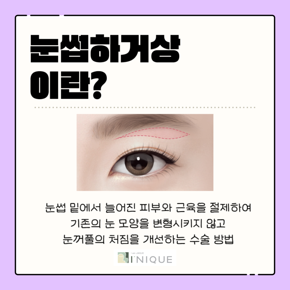 If You Want to Improve Drooping Eyelids in Middle-Aged Men image 3