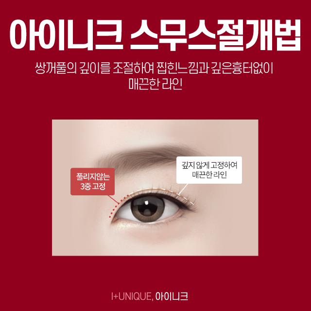 눈성형수술, 보다 신중한 선택이 이루어져야 하는 이유 관련 이미지 4