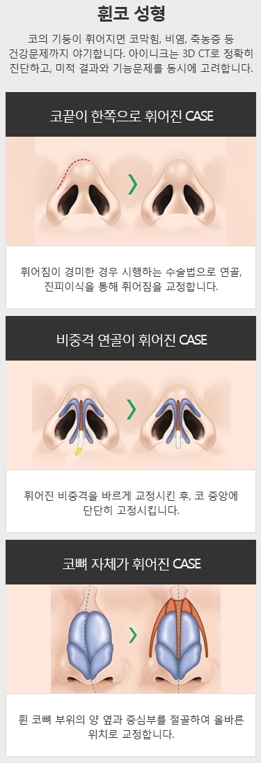 삐뚤어진코 아이니크에서 바로 잡자! 관련 이미지 2
