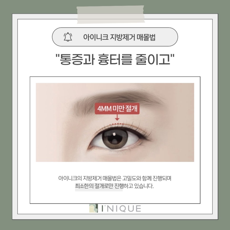 남자쌍수잘하는곳 찾을 때 관련 이미지 4