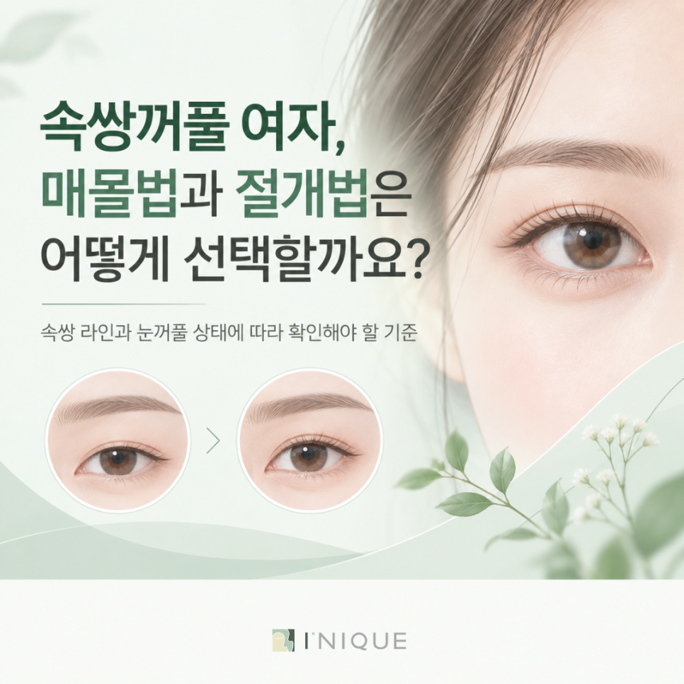 속쌍꺼풀 여자, 매몰법과 절개법은 어떻게 선택할까요? 관련 이미지 1