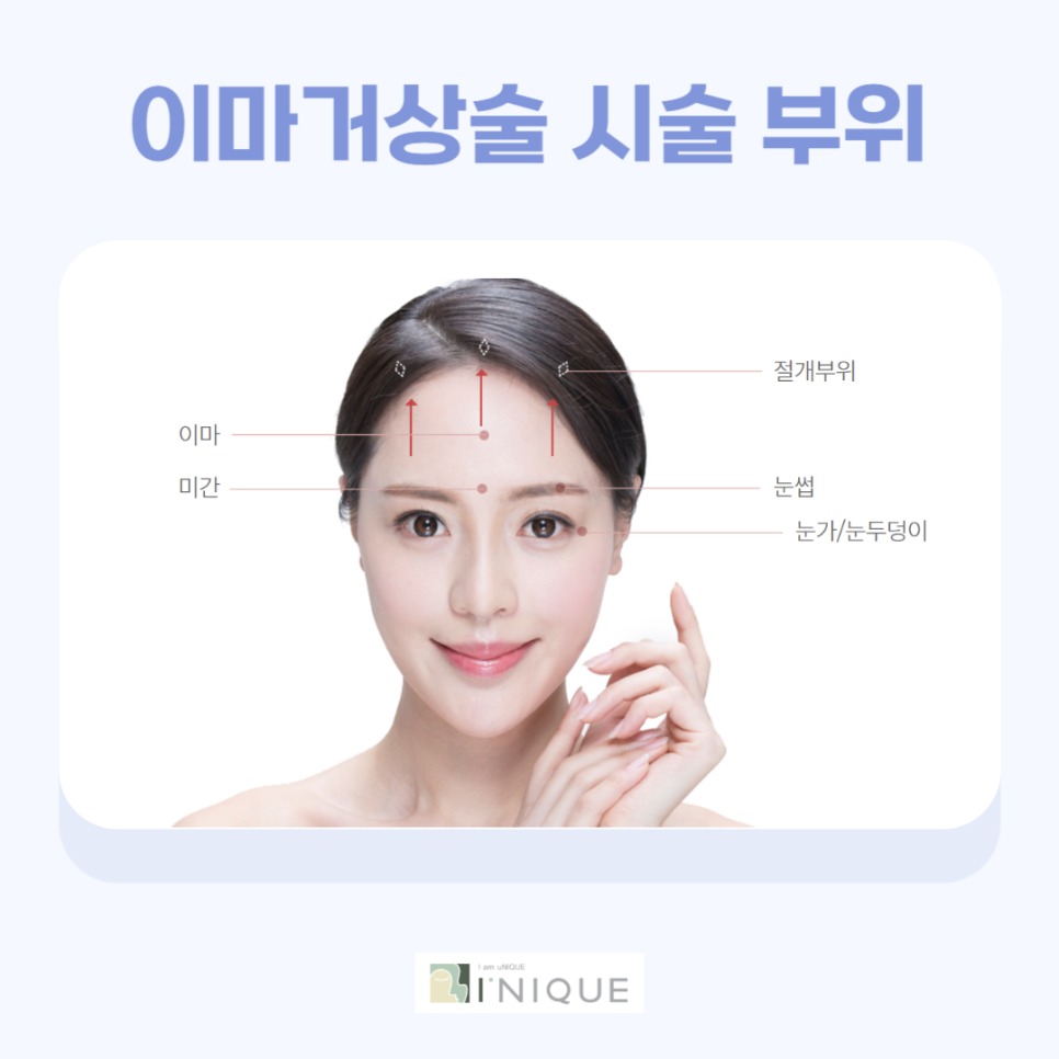 눈처짐잘하는병원, 탄력과 생기를 동시에! 관련 이미지 3