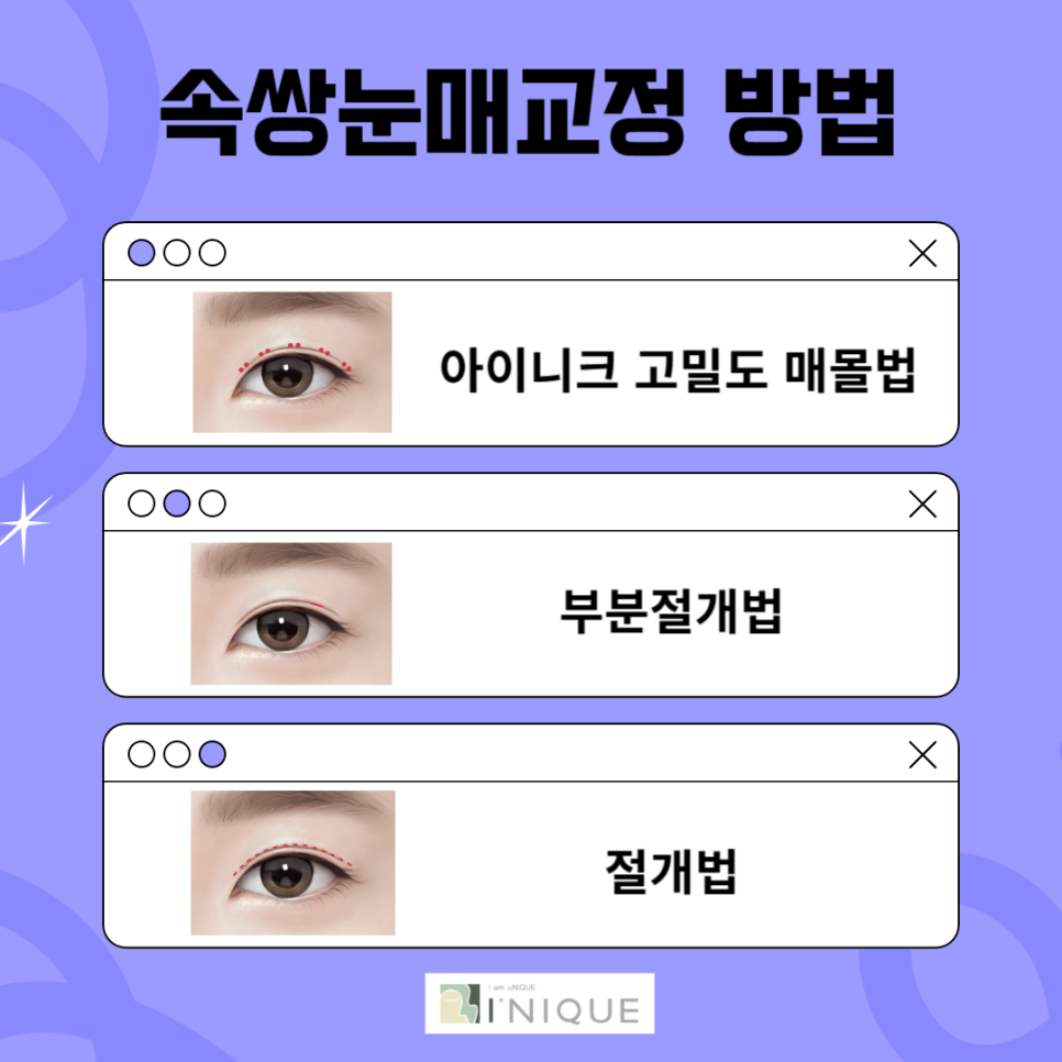 남자 눈매교정 붓기 없이 성공하기 관련 이미지 3