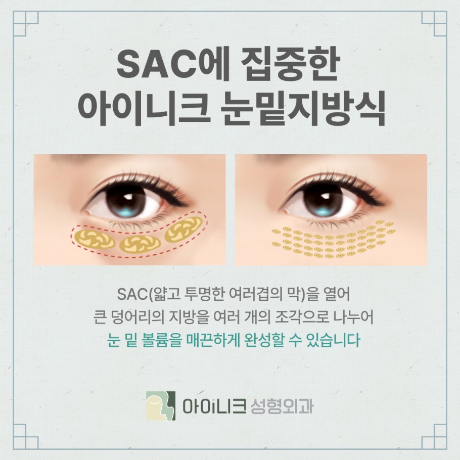 눈밑지방제거수술비용과 새로운 진행방식 관련 이미지 7