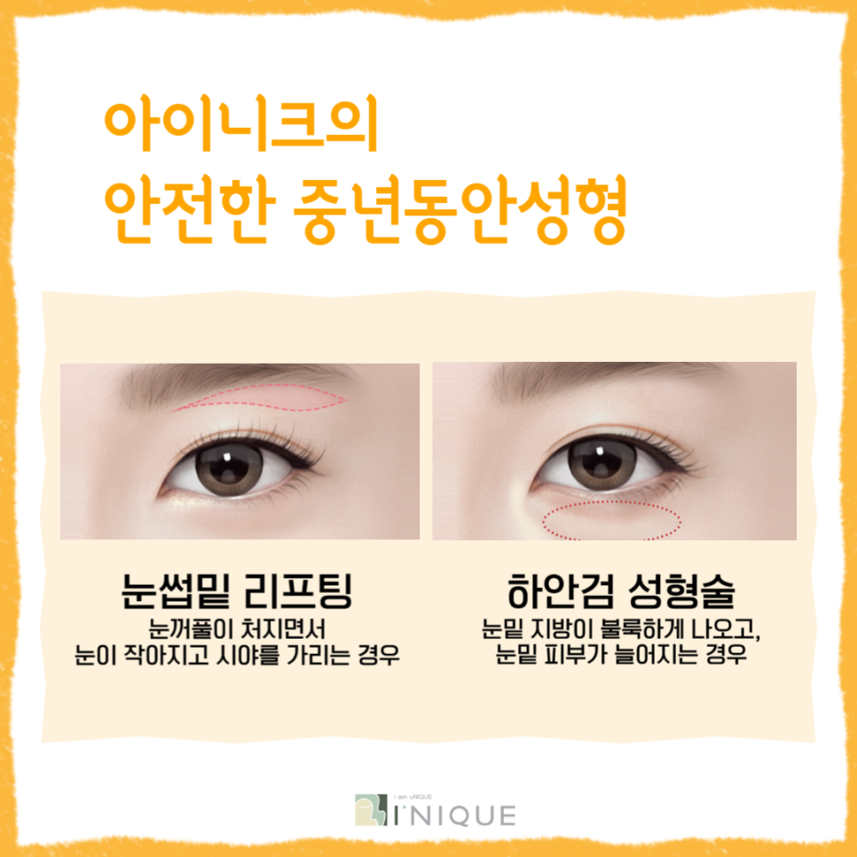 Have You Heard About Middle-Age Eye Rejuvenation Surgery? image 2